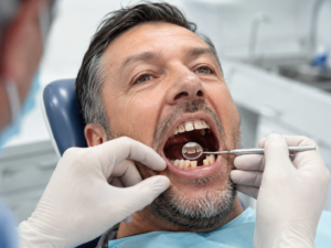 Top Signs You May Need Full Mouth Rehabilitation Treatment