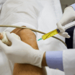 stem 20cell 20therapy 1