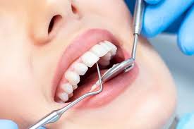 Is Root Canal Treatment in Scarborough Worth It for Tooth Pain? 1 Is Root Canal Treatment in Scarborough Worth It for Tooth Pain?