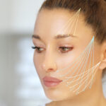 Are Facial Thread Lifts Safe Risks and Side Effects Explained