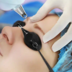 Clear glow skin reset Syringoma Removal Treatment beauty wave unlock
