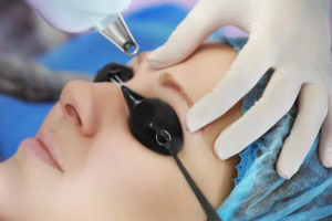 Clear glow skin reset Syringoma Removal Treatment beauty wave unlock 1 Clear glow skin reset Syringoma Removal Treatment beauty wave unlock