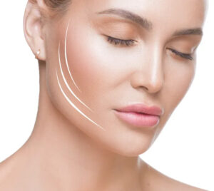 Endolift Skin Tightening London: Non-Surgical Facelift Explained 1 Endolift Skin Tightening London: Non-Surgical Facelift Explained