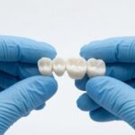 Damaged or Missing Teeth? How Crown & Bridges Treatment Can Help