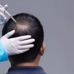 Is G Cell Treatment the ultimate upgrade for hair health glow?