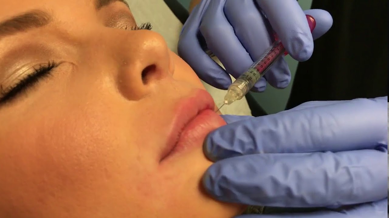 restylane dubai2