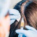Understanding Exosome Hair Growth: The Dubai Expert View 2 Understanding Exosome Hair Growth: The Dubai Expert View
