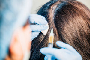 Understanding Exosome Hair Growth: The Dubai Expert View 1 Understanding Exosome Hair Growth: The Dubai Expert View