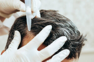 Complete Women’s Guide to Exosome Hair in Dubai 2026