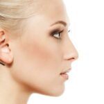 Otoplasty in IslamabadPakistan