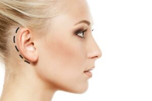 Can Teenagers Benefit from Otoplasty in Islamabad?