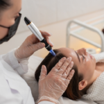 GFC Treatment in Bangalore: Is It Effective for Hair Fall?