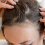 Hair Transplant in Riyadh with Customized Graft Planning 3 Hair Transplant in Riyadh with Customized Graft Planning