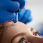 How to Choose the Best Clinic for Skinpen Microneedling in Altrincham (Checklist) 3 How to Choose the Best Clinic for Skinpen Microneedling in Altrincham (Checklist)