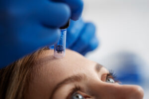 How to Choose the Best Clinic for Skinpen Microneedling in Altrincham (Checklist)