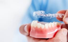 How Invisible Braces Can Transform Your Smile Without Metal Brackets 1 How Invisible Braces Can Transform Your Smile Without Metal Brackets