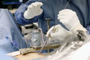 Spine Surgery Recovery Timeline: Myths, Aftercare Tips and What Really Happens After the Operation