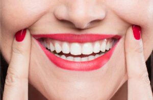 How Smile Makeovers in Tirupati Are Transforming Smiles and Self-Esteem 1 How Smile Makeovers in Tirupati Are Transforming Smiles and Self-Esteem