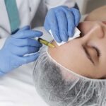 PRP Microneedling Toronto 1