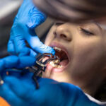 Wisdom Tooth Removal in Toronto: 7 Warning Signs