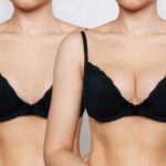 Is Breast Lift the Option for Refined Curves and Lifted Symmetry? 3 Is Breast Lift the Option for Refined Curves and Lifted Symmetry?