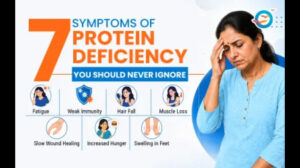 7 Symptoms of Protein Deficiency You Should Never Ignore?