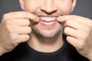 Teeth Whitening in Riyadh for Advanced Stain Removal
