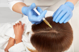 What to Expect from PRP Hair Restoration in Riyadh