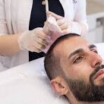 Hair Transplant in Dubai: What Makes Results Look Natural?