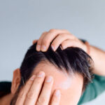 Exosomes Therapy for Hair Loss in Riyadh 17