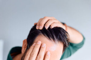 The Benefits of Exosome Therapy in Stimulating Hair Growth Naturally