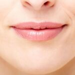 Lip Reduction in Dubai11