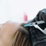 Why Choose Exosome Therapy for Hair Loss: An Educational Overview 3 Why Choose Exosome Therapy for Hair Loss: An Educational Overview