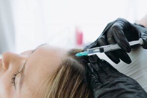 Why Choose Exosome Therapy for Hair Loss: An Educational Overview