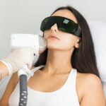 How Does Laser Hair Bleaching Improve Appearance?