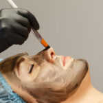 7 Reasons Why Enfield Royal Clinic Leads in Carbon Peel Treatments
