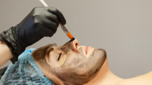 7 Reasons Why Enfield Royal Clinic Leads in Carbon Peel Treatments 1 7 Reasons Why Enfield Royal Clinic Leads in Carbon Peel Treatments
