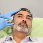 Sculptra Fillers and Non-Surgical Facelift Options in Riyadh 3 Sculptra Fillers and Non-Surgical Facelift Options in Riyadh