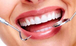 Lumineers Teeth Houston Guide for a Natural Looking Smile Makeover 1 Lumineers Teeth Houston Guide for a Natural Looking Smile Makeover