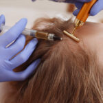 Why Choose Exosome Hair in Dubai for Hair Regrowth Today