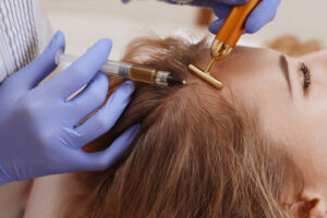 Why Choose Exosome Hair in Dubai for Hair Regrowth Today 1 Why Choose Exosome Hair in Dubai for Hair Regrowth Today