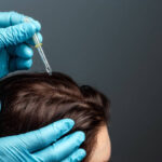 Top Benefits of Exosome Hair in Dubai for Hair Restoration 3 Top Benefits of Exosome Hair in Dubai for Hair Restoration