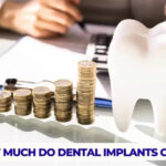 How to Choose the Right Dental Implant Treatment Within Your Budget