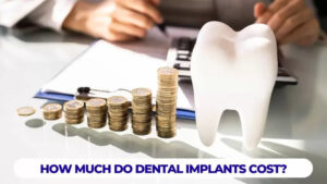 How to Choose the Right Dental Implant Treatment Within Your Budget 1 How to Choose the Right Dental Implant Treatment Within Your Budget