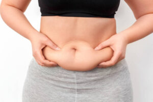 The Evolution of Liposuction Techniques in Riyadh’s Cosmetic Industry