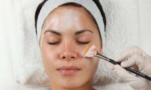 Why Is PCA Peel Treatment So Popular for Glowing Skin? 1 Why Is PCA Peel Treatment So Popular for Glowing Skin?