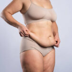 Tummy Tuck in Dubai After Pregnancy Body Makeover 3 Tummy Tuck in Dubai After Pregnancy Body Makeover