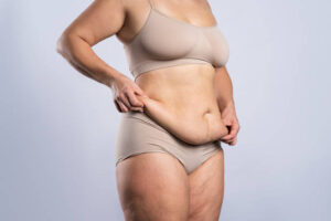 Tummy Tuck in Dubai After Pregnancy Body Makeover