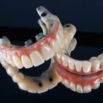 Smile nambour all on 4 dental implants