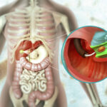 Biliary Tract and Liver Surgery in Dubai for Fast Relief 3 Biliary Tract and Liver Surgery in Dubai for Fast Relief